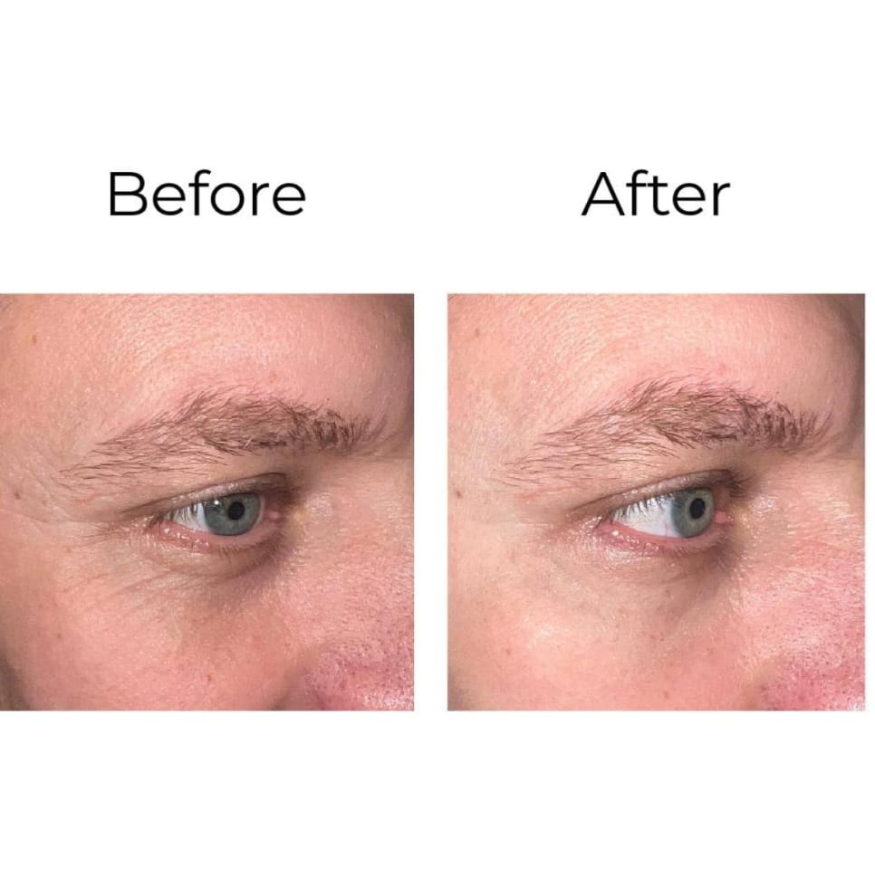 Peptilux - Anti-wrinkle eye cream with shock action effect with LIPHASYN™ - 20 ml